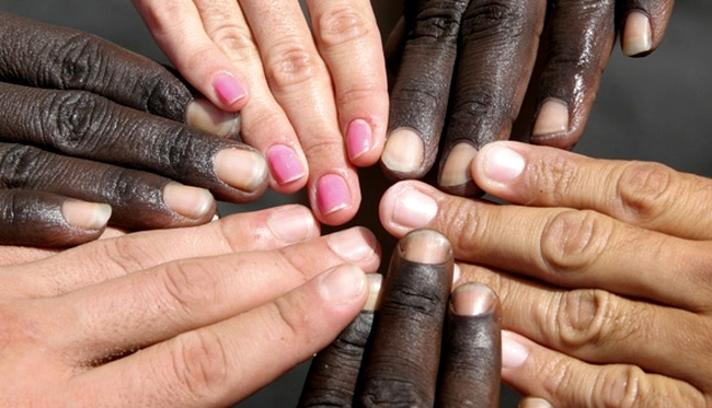 Le Monde l’admet : « Nier les différences interraciales ­est contre-productif »